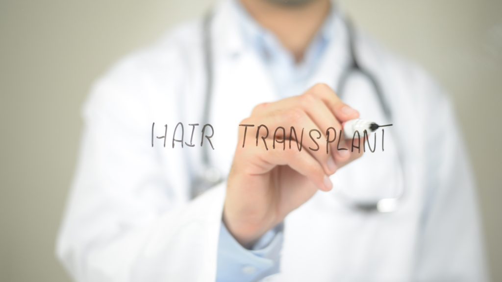 Leitfaden Haartransplantation